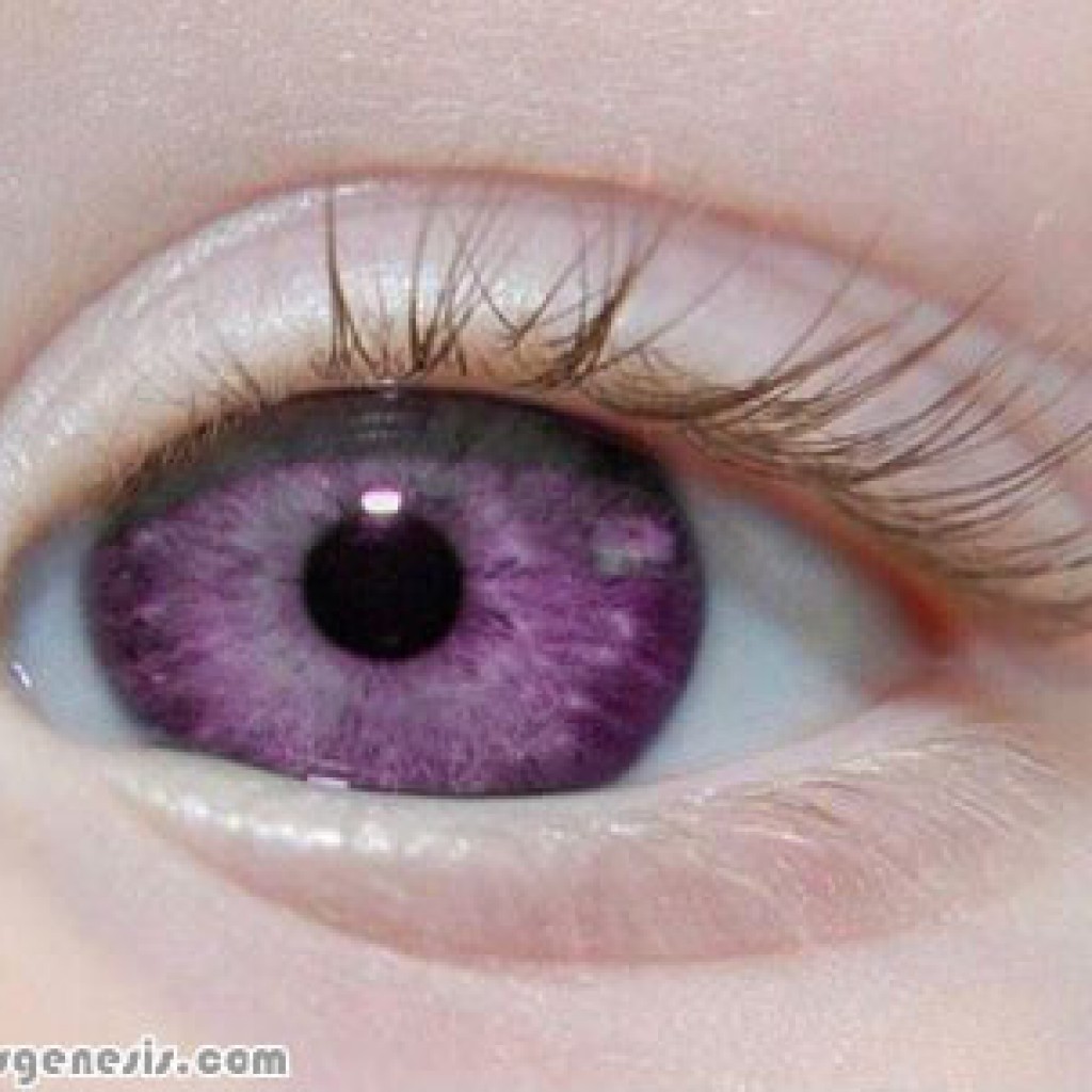 genetic mutation purple eyes