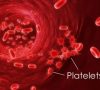 Essential Thrombocythemia Prognosis and Treatment