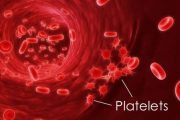 Essential Thrombocythemia Prognosis and Treatment Essential Thrombocythemia Prognosis and Treatment