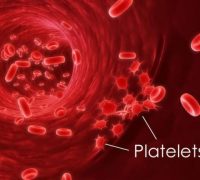 Essential Thrombocythemia Prognosis and Treatment