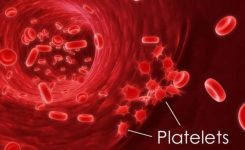 Essential-Thrombocythemia-Prognosis-and-Treatment Essential-Thrombocythemia-Prognosis-and-Treatment